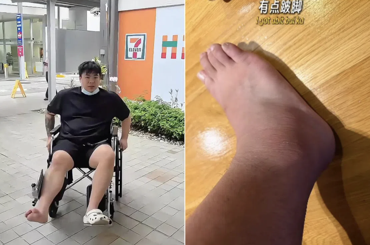 Si tu es en surpoids, évite les excès : Une influenceuse de Singapour se blesse au pied après un pull-up et voit son goutteux resurgir !